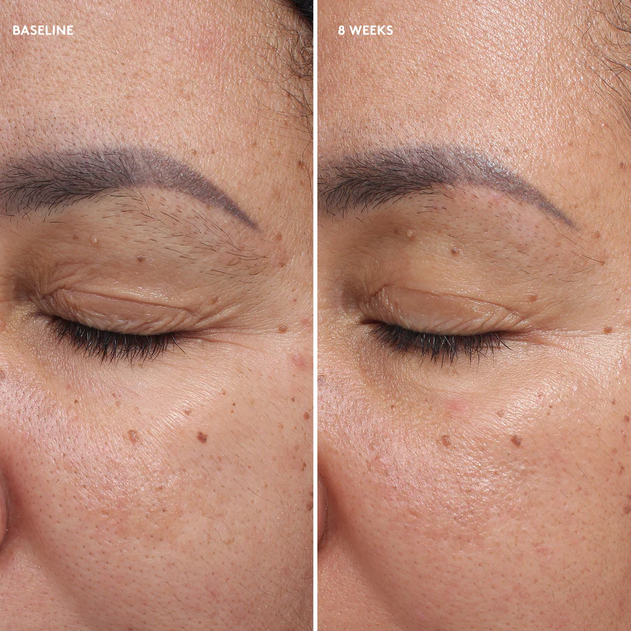 Total Eye® Firm & Repair Cream - Slika 2